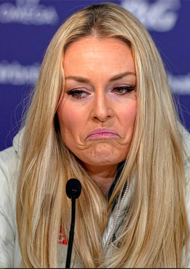 Lindsey Vonn Defies Amputation Fears: ‘I Will’ Return to the Slopes After Gruesome Olympic Leg Smash