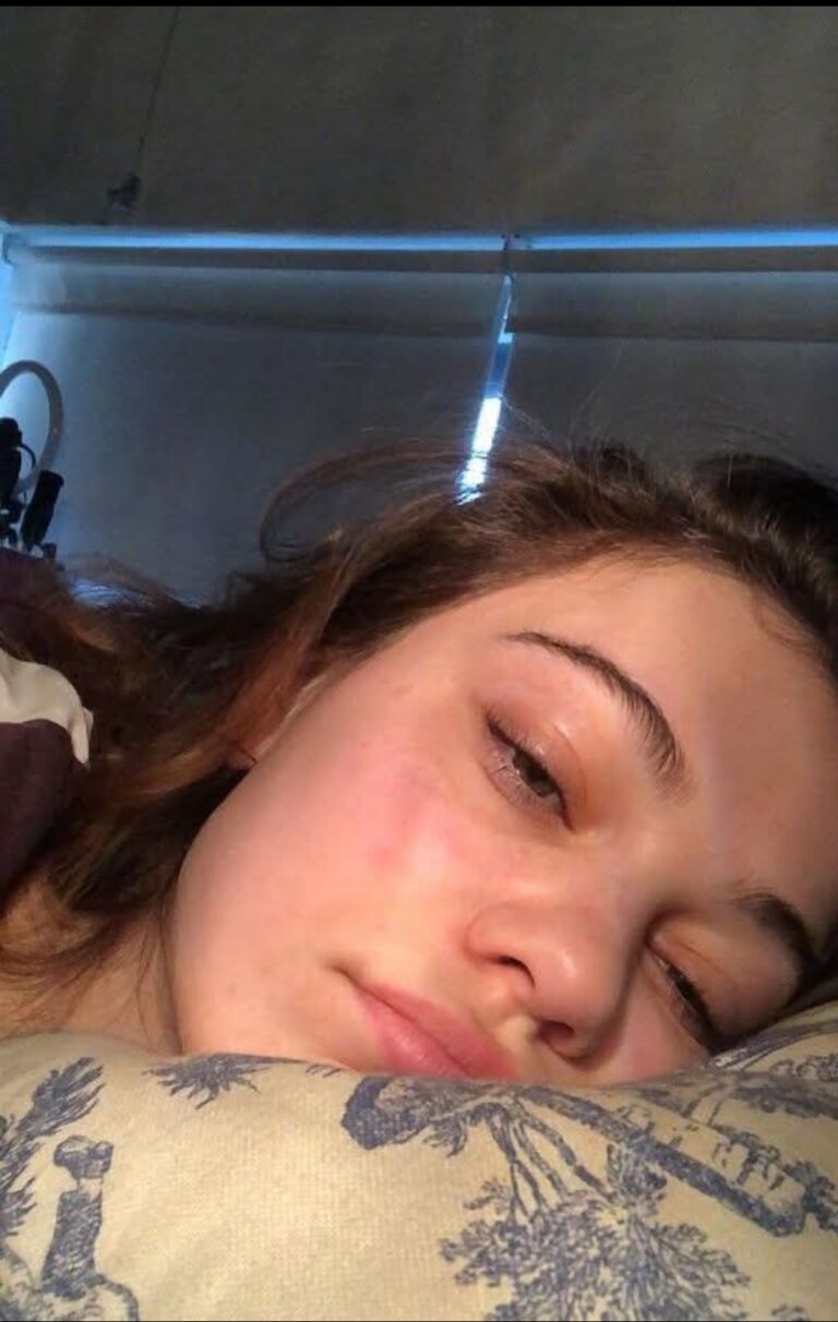 Heartbreaking Update from Lindsey Vonn: ‘Struggling’ After 6-Hour Surgery, But She’s Fighting Like the Champion She Is – Sending All Our Love