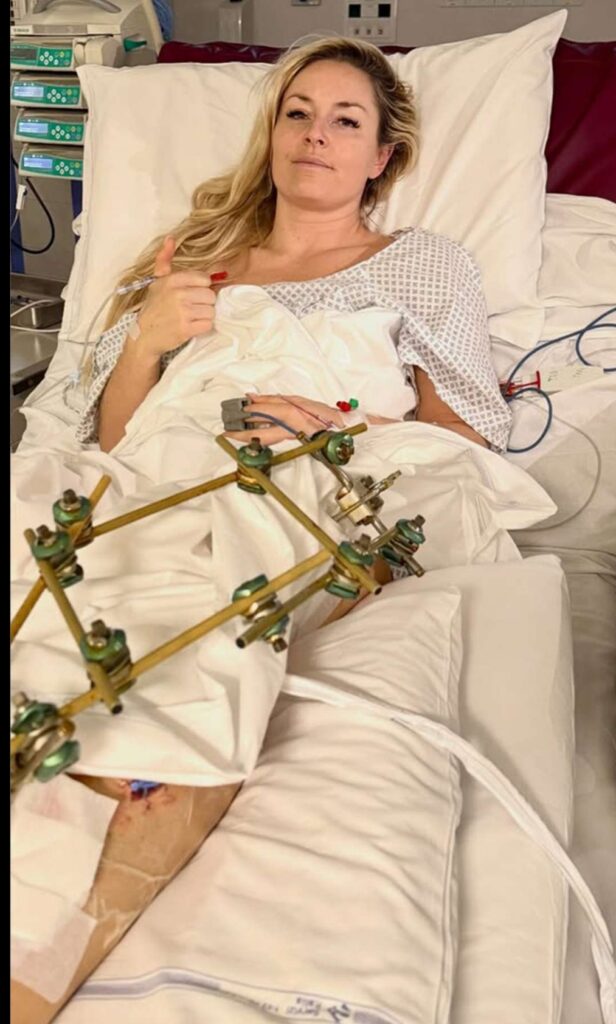 Lindsey Vonn Tears Up Recalling Olympic Nightmare: “I Almost Lost My Leg Forever”