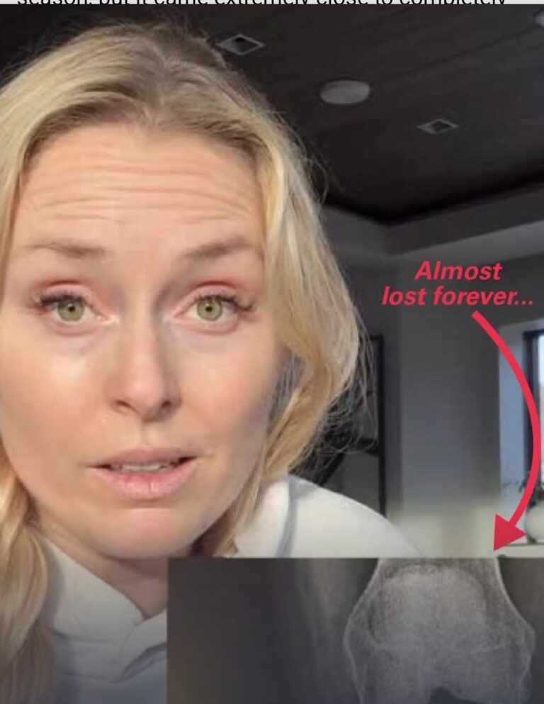 Lindsey Vonn Reveals Olympic Crash Nearly Cost Her Leg: “Extremely Close to Completely Changing My Life”