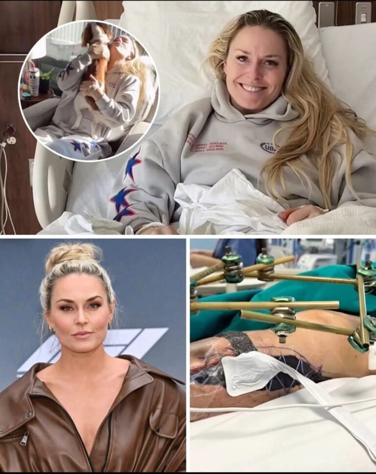 “All My Muscles Are Gone”: Lindsey Vonn Shares Stark Photo of Legs After Multiple Surgeries – Raw Reality of Olympic Crash Recovery Hits Hard