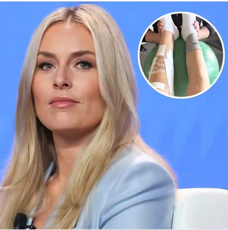 Olympic Legend Lindsey Vonn’s Brutal Battle: Leg Saved from Amputation After Fifth Surgery – “Long Road Ahead”