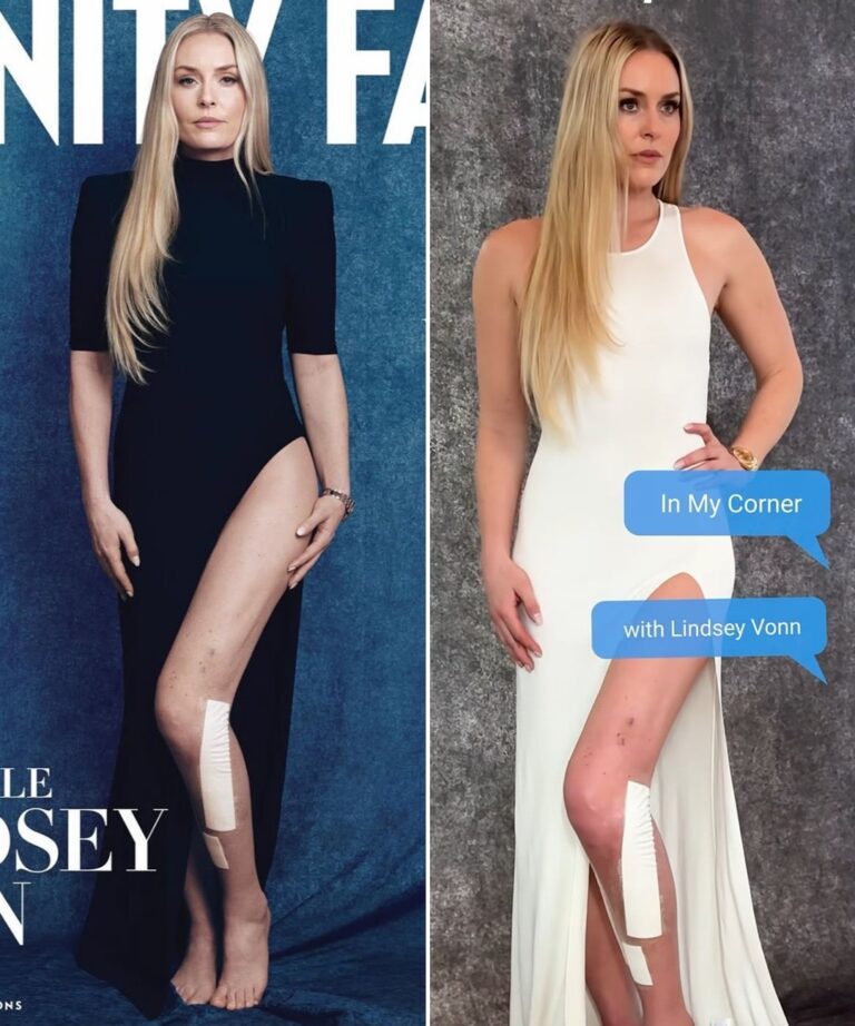 Scars Aren’t Flaws — They’re Her Blueprint: Lindsey Vonn’s Raw, Unfiltered Power Is Redefining Strength