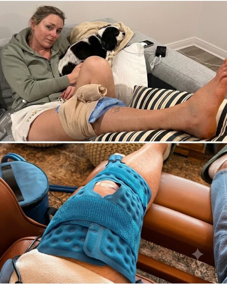 “I’m Basically Lindsey Vonn” — Amateur Athlete’s Hilarious Reality Check About Pro Life vs Everyday Pain Goes Viral