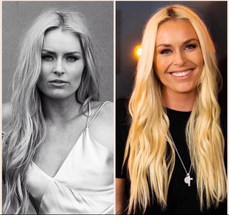 Vonn’s Future on the Edge: Olympic Legend Refuses to Rush Retirement Call After Gruesome Crash