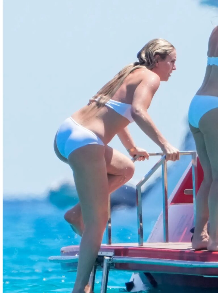 Lindsey Vonn Stuns in Bikini, Flaunts Epic Leg Scars on Luxury Yacht Just 4 Months After Near-Amputation Nightmare