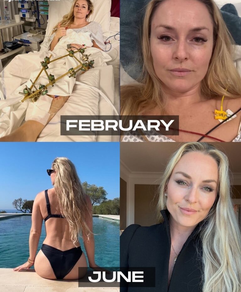 Lindsey Vonn Bounces Back Like a Boss — Proving Why Her Legacy Is Straight-Up Untouchable