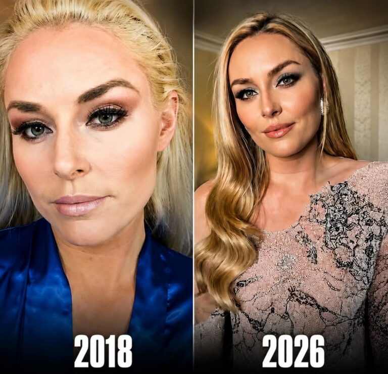 Lindsey Vonn: From Ski Champion to Timeless Global Icon – Greatness That Transcends the Slopes