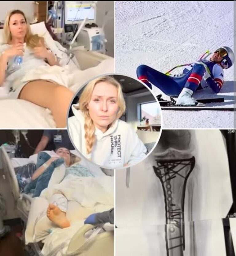 Lindsey Vonn Admits Ankle Is “Still Broken” Five Months After Olympic Crash