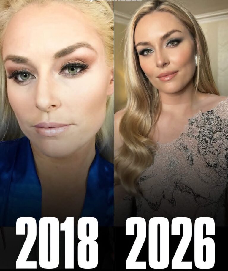 41-Year-Old Lindsey Vonn Looks Like She’s Aging BACKWARDS — Fans Can’t Believe These 2026 Photos